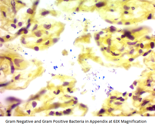 Product: Gram Stain Kit