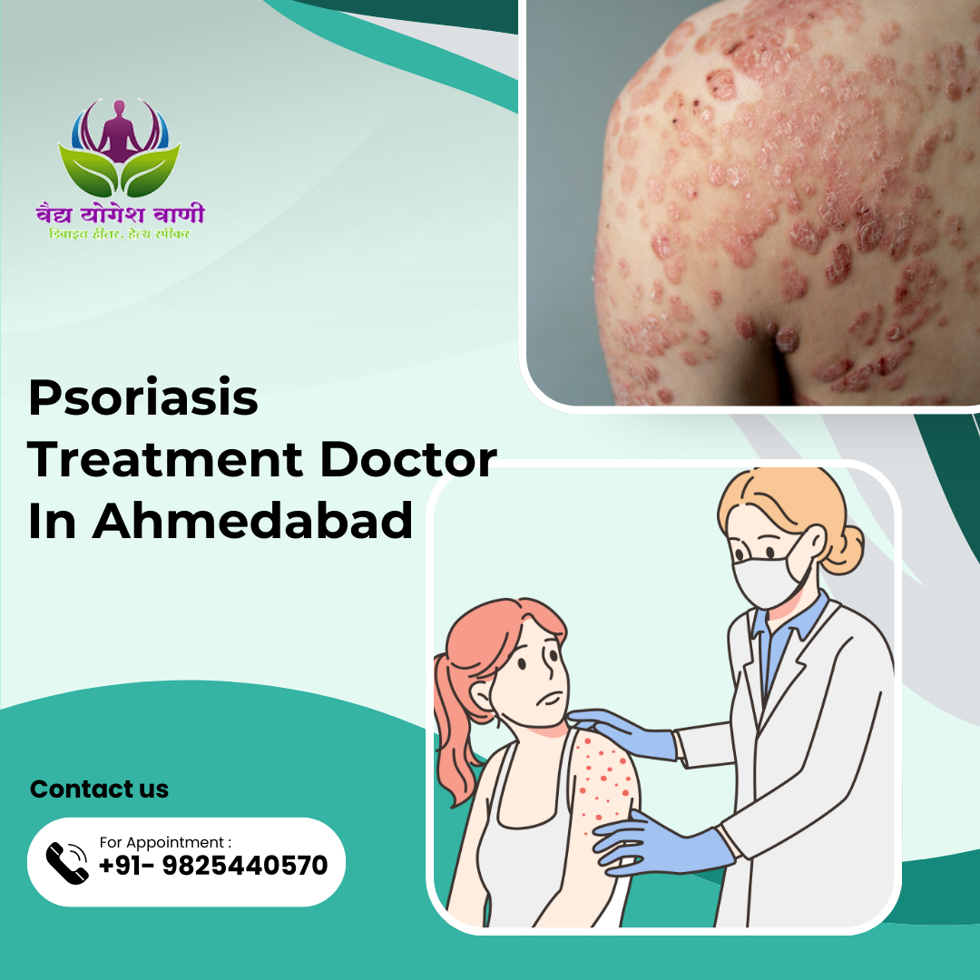 Product: Psoriasis Treatment Doctor In Ahmedabad
