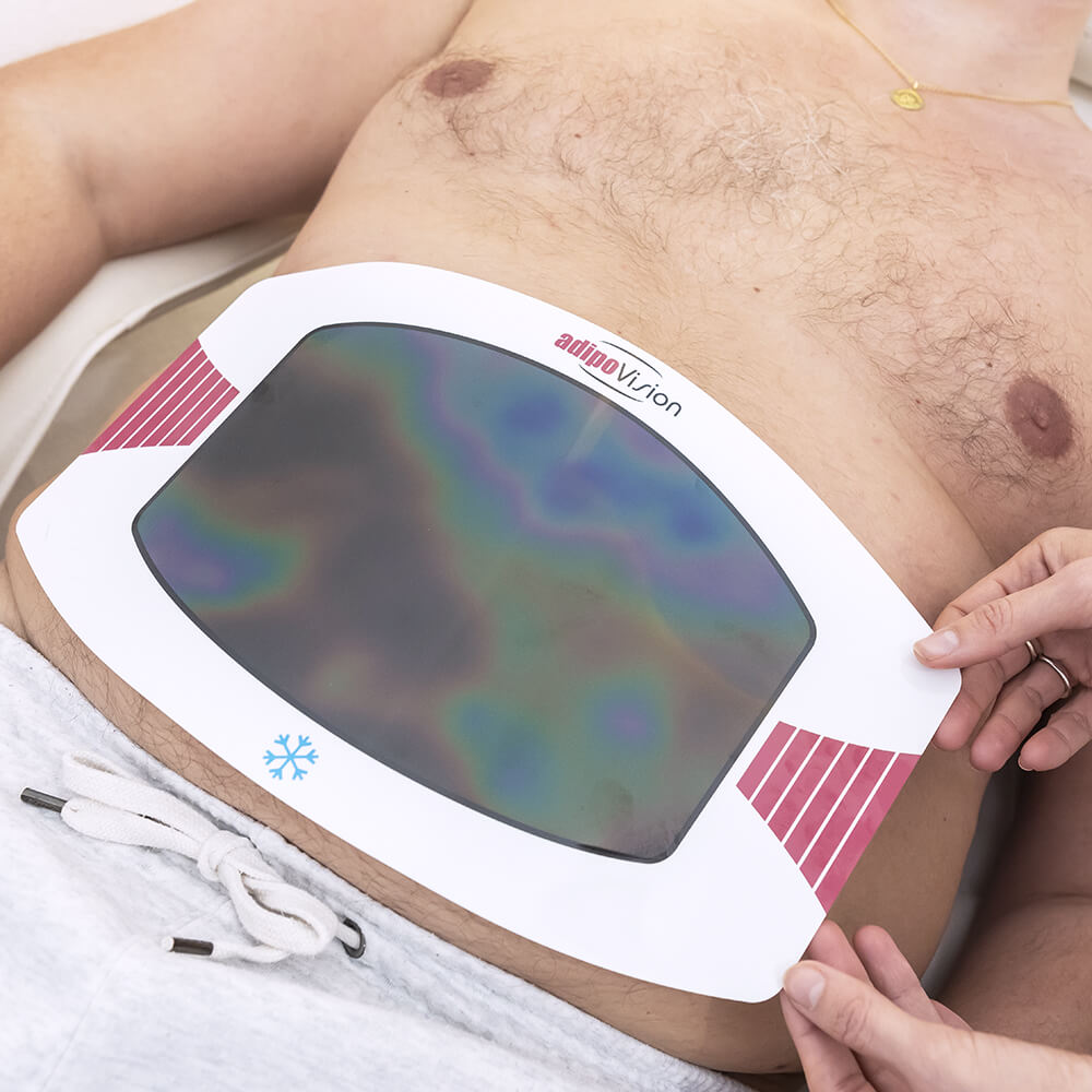 Product: AdipoVision PLUS